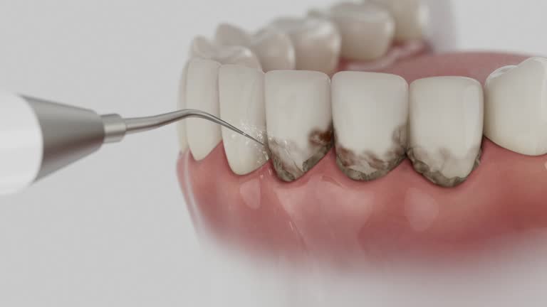 Trusted Teeth Cleaning And Checkup service in Flatonia, TX - Dentist Open Now